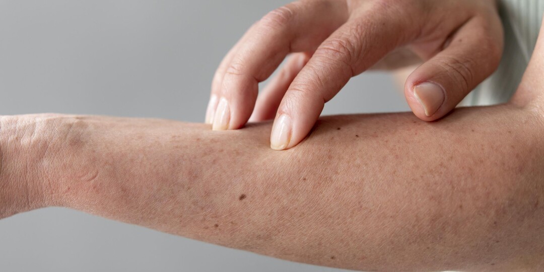 6 кожных симптомов, которые могут указывать на серьёзные процессы