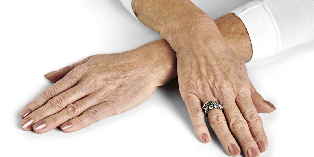 7 изменений на руках после 55, которые могут быть связаны с сосудами