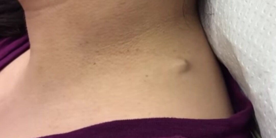 Образование, которое медленно увеличивается — что это может быть