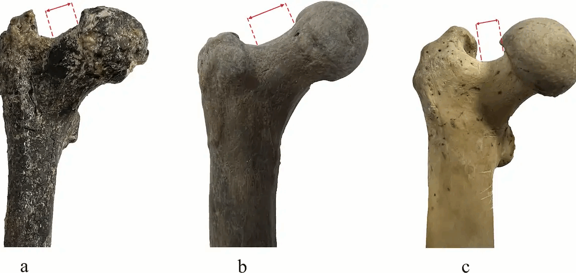 Бедренная кость грекопитека из Азмака, Болгария, (слева) в сравнении с бедренной костью Люси (австралопитек афарский) (в центре) и бедренной костью шимпанзе (справа). У предков человека — грекопитека и австралопитека — шейка бедренной кости (обозначена красным) длиннее и направлена вверх сильнее, чем у шимпанзе.📷
