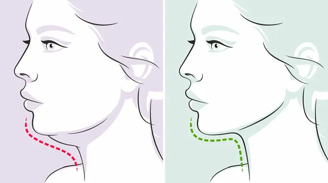 Лицо подтянется, второй подбородок уйдет: 3 упражнения, чтобы овал лица всегда был чёткий
