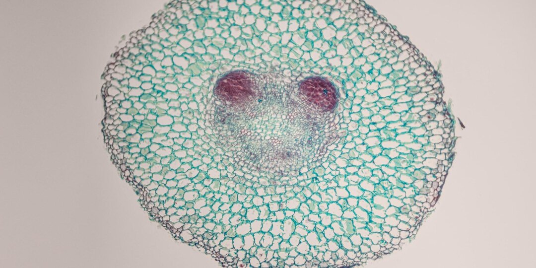 Специалист объяснила, как получать из еды клетчатку, даже если не любите овощи