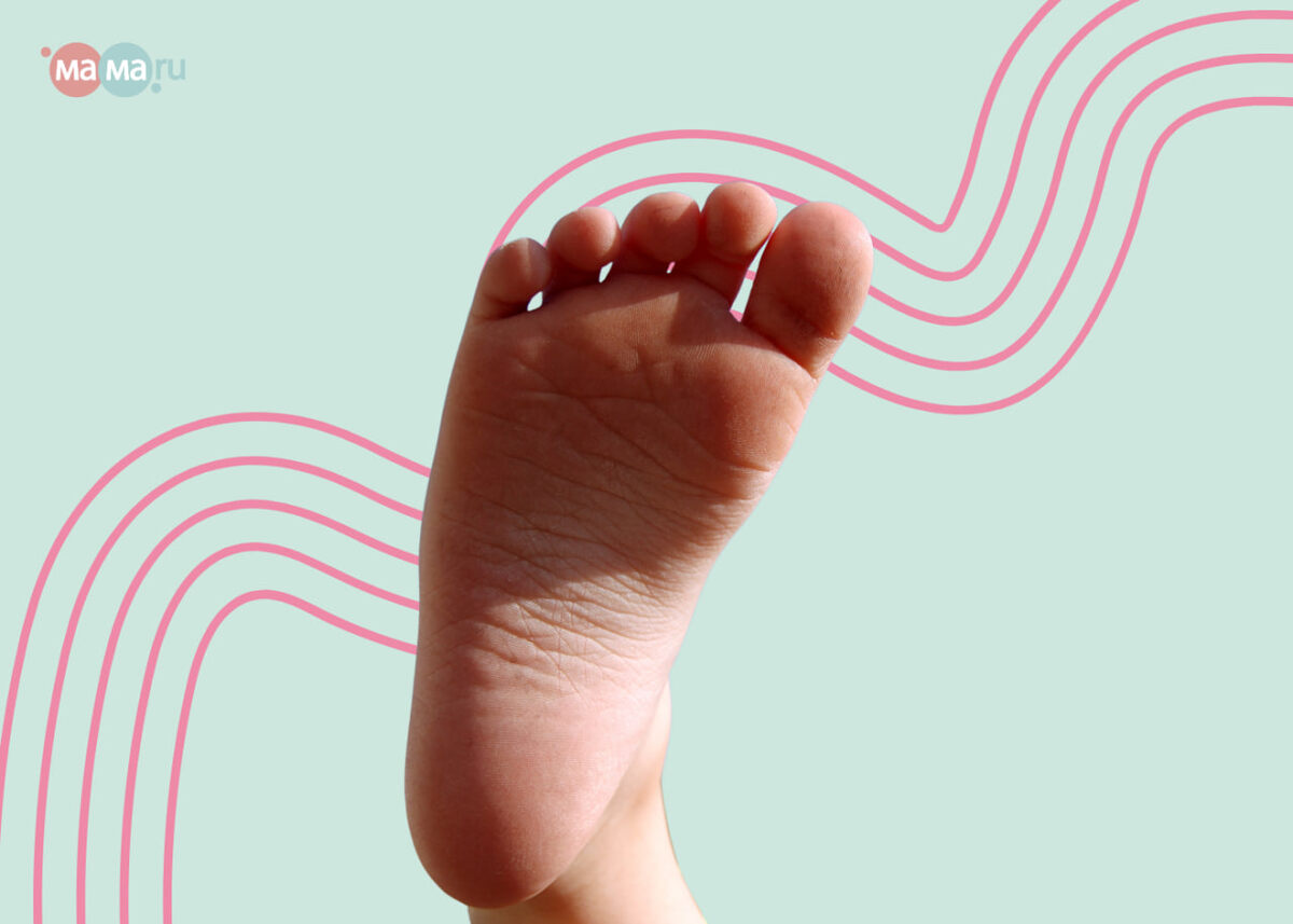 Плоскостопие у детей