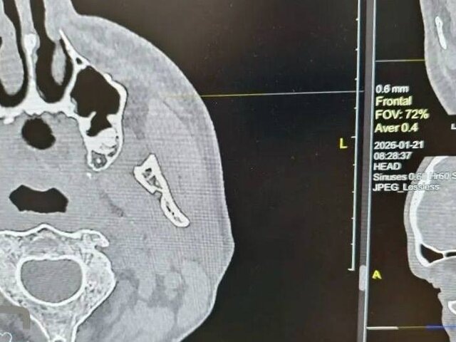    Фото: телеграм-канал "ГАУЗ "ГБ" г. Орска"