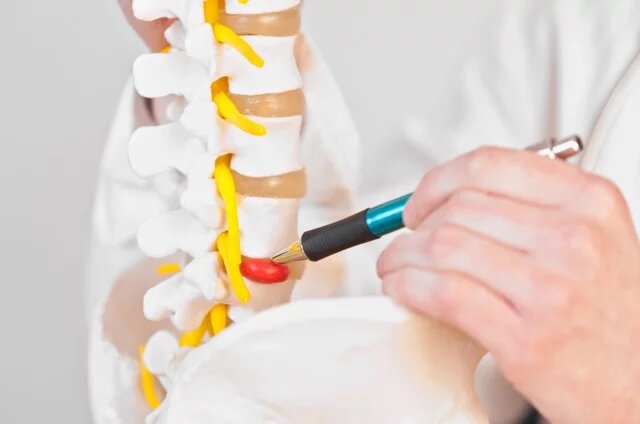    Когда при грыже необходима операция?