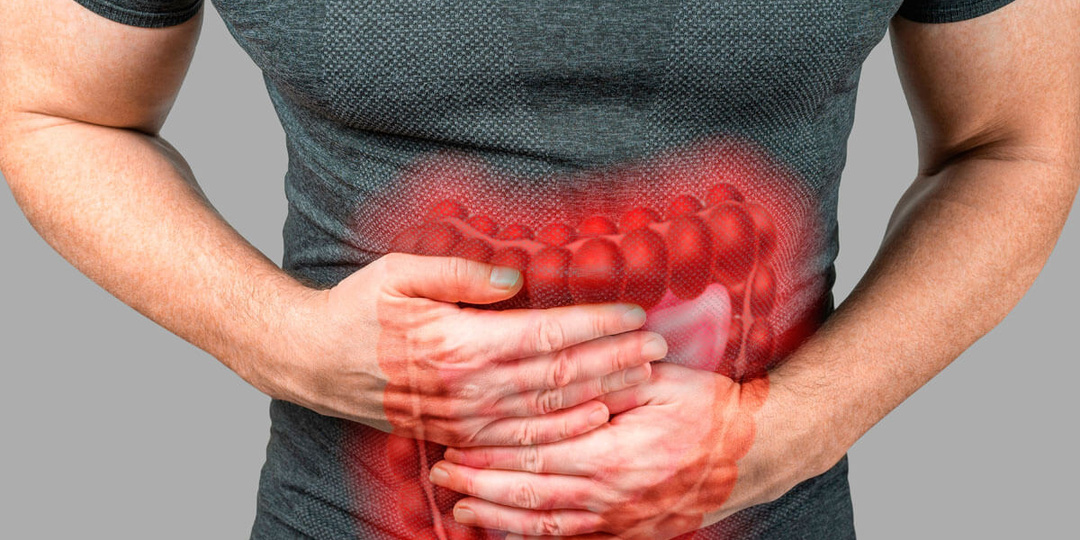 СИМПТОМЫ Различных Типов ЯЗВЕННОГО КОЛИТА