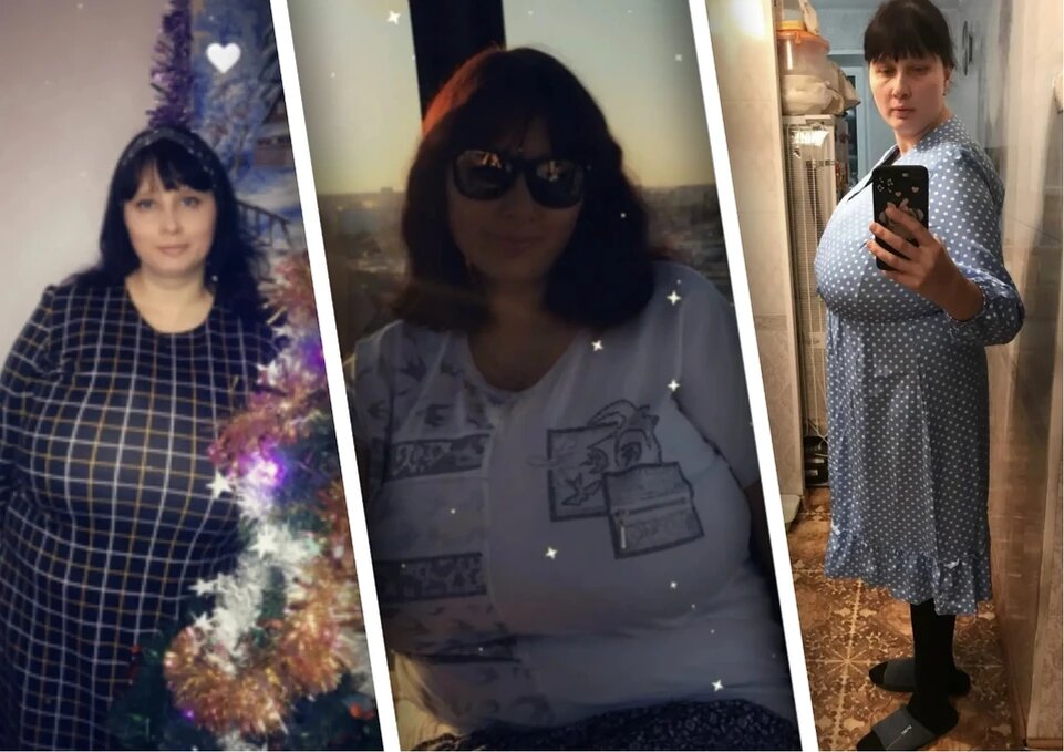 Екатерина стеснялась выходить на улицу и боялась чужих взглядов. Фото: КП-Челябинск