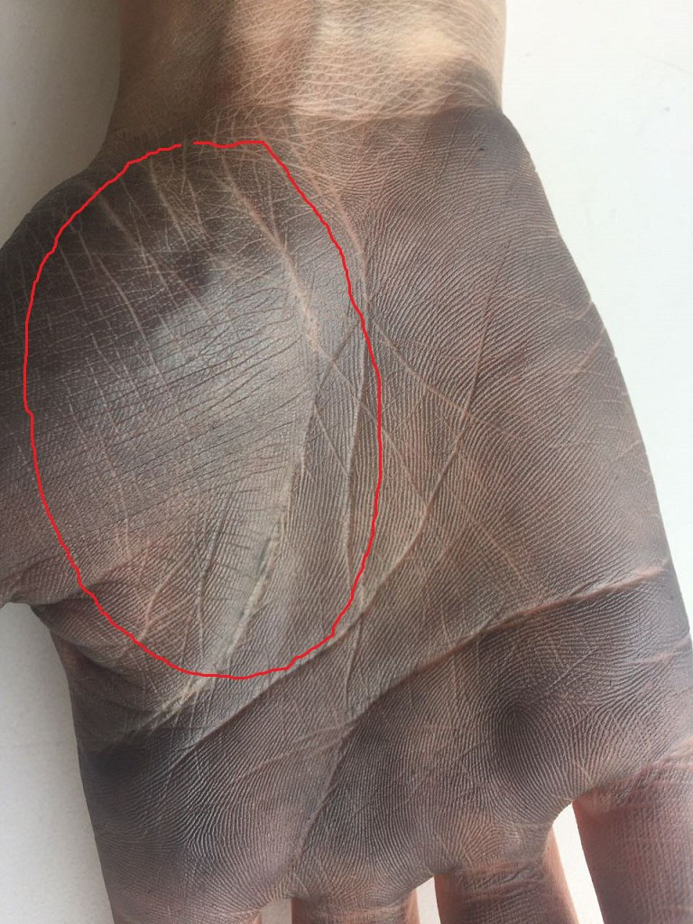 Холм Венеры (обведен красным) усеян частыми и тонкими горизонтальными линиями - линиями стресса. Фото из открытого источника, моя обработка