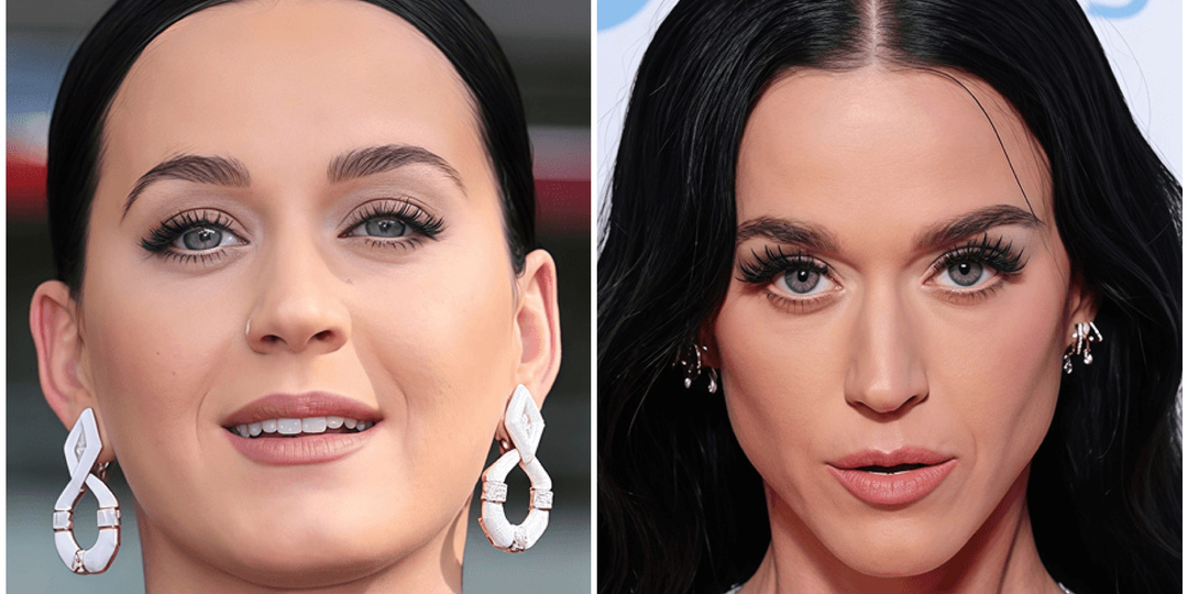 19 знаменитостей, которых не узнать после удаления комков Биша