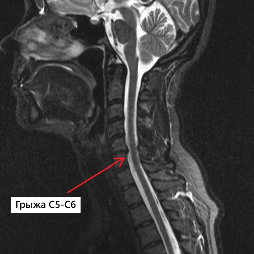 Сагиттальная проекция