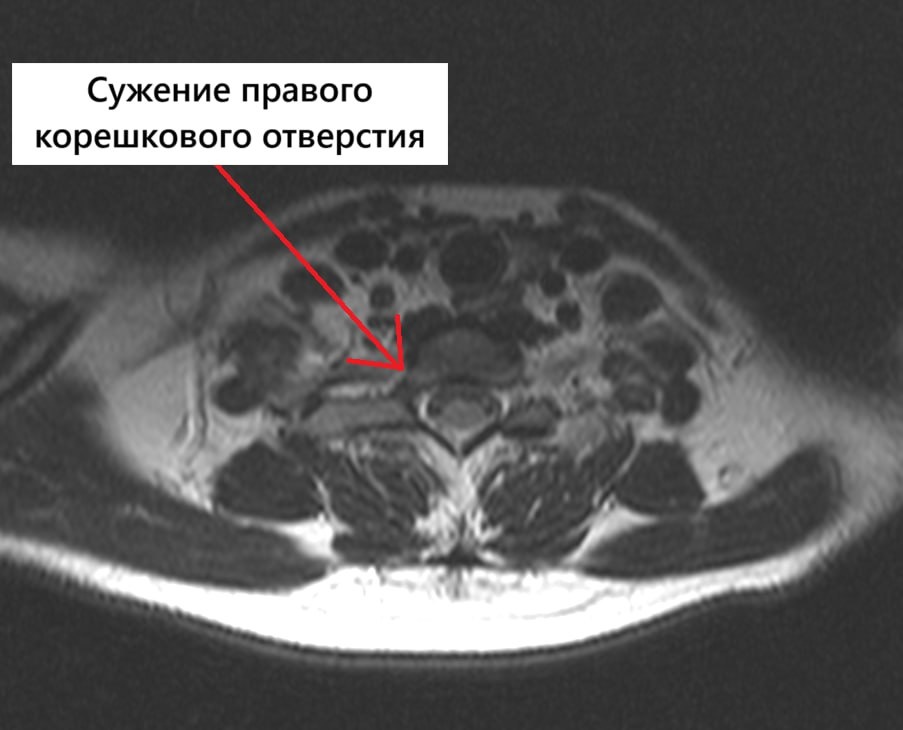 Аксиальная (поперечная) проекция 
