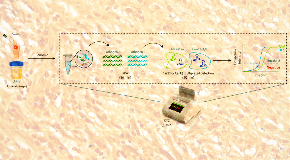   N + 1; Nephron / Wikimedia Commons / CC-BY-SA-3.0; Soo Jen Low et al. / The Lancet Microbe, 2026