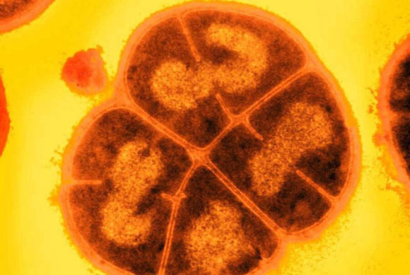 Deinococcus radiodurans.