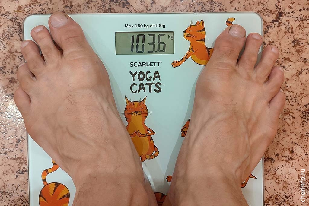    Такое направление в медицине называется бариатрической хирургией. Одна из методик - удаление части желудка через небольшие проколы