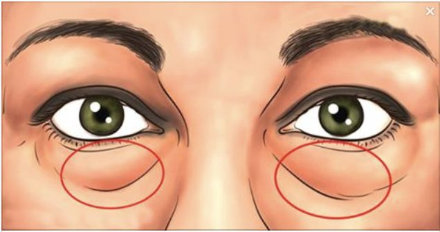 Сейчас у меня нет мешков под глазами, а если и появятся, то я их быстро убираю: минутное упражнение, которое всегда помогает