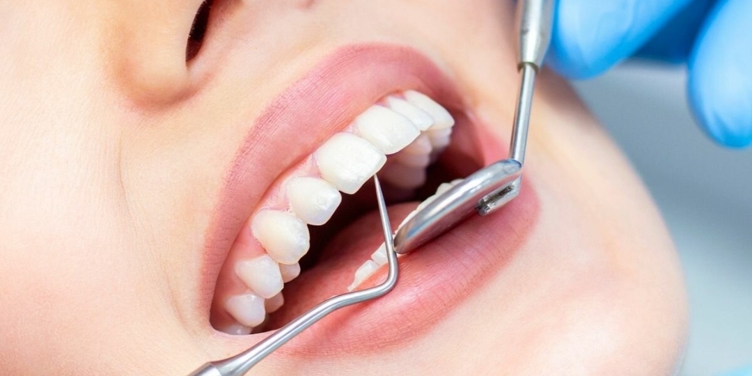 Увеличение стоимости услуг стоматологии в России к концу текущего года ожидается до 50%