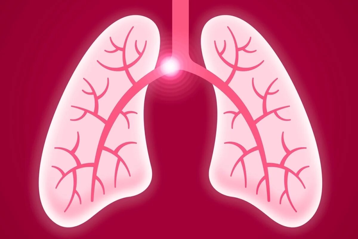    Тромб мигрирует незаметно и безболезненно, а убивает человека практически мгновенно.