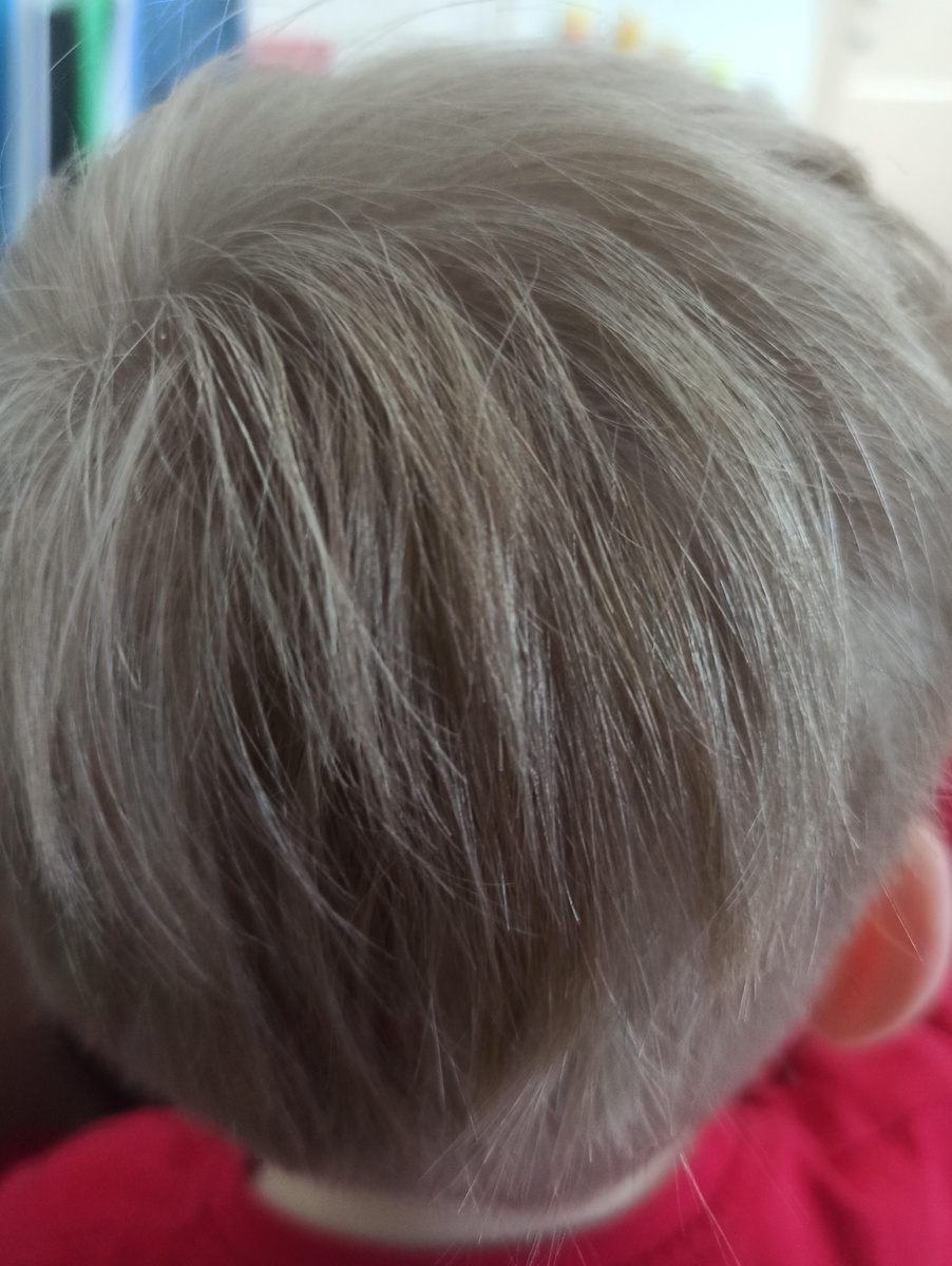 ...Голова директора. Вид сзади с коленей капитана... 