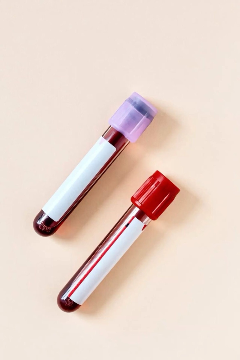 Источник фото Pinterest