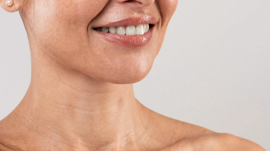 Горизонтальные складки — кольца Венеры