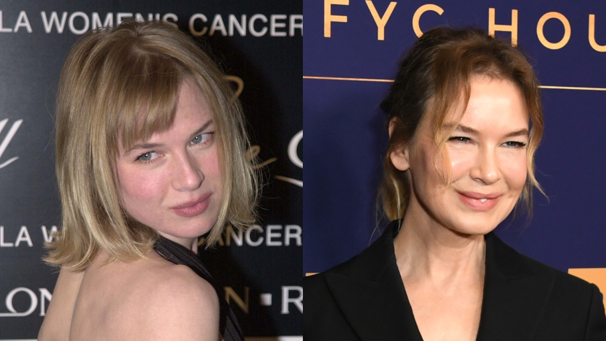 Рене Зелвегер сделала подтяжку и попрощалась с естественной красотой