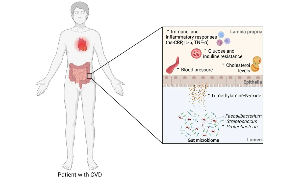 Изменения в микробиоте кишечника у пациентов с сердечно-сосудистыми заболеванияями (источник: https://www.mdpi.com/2218-273X/14/6/731)