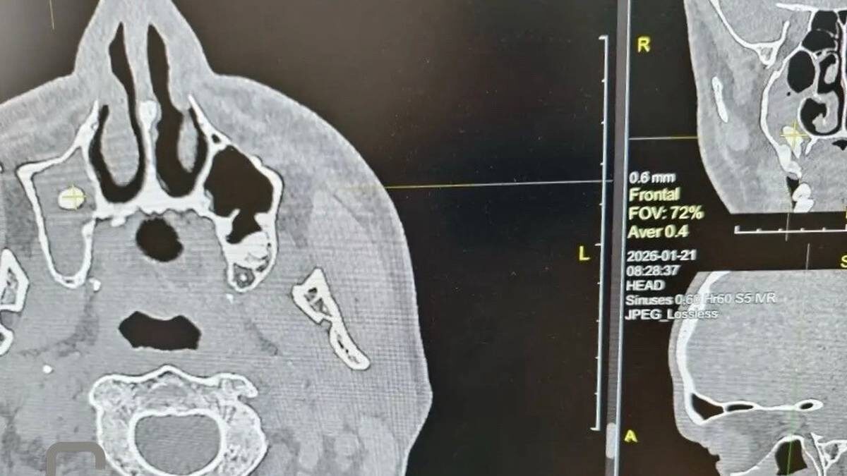    Фото: ГАУЗ ГБ Орска