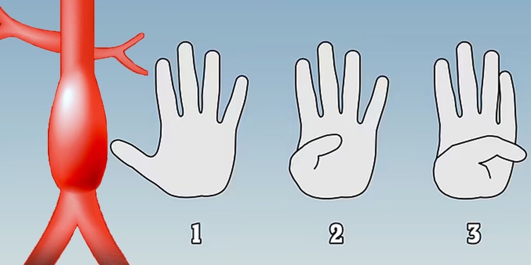 Этот признак на руках может говорить о проблемах с сердцем