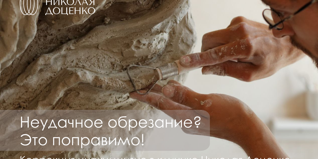 УРОЛОГИЯ: КОРРЕКЦИЯ РУБЦОВ ПОСЛЕ НЕУДАЧНО ВЫПОЛНЕННОГО ЦИРКУМЦИЗИО