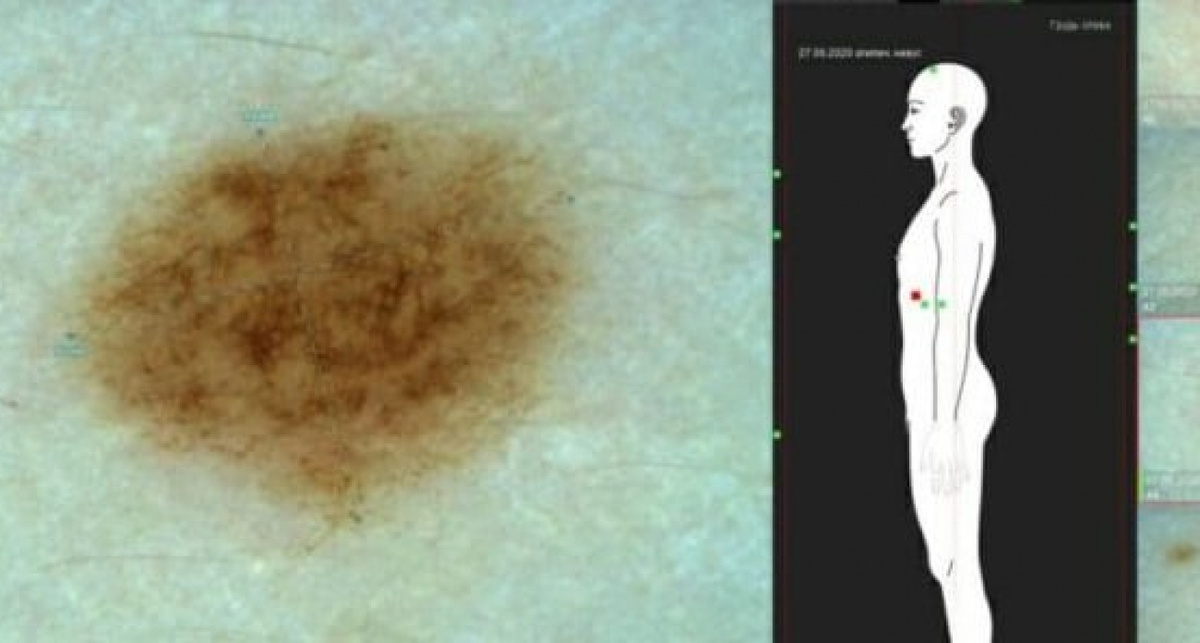    Стационар-пресс