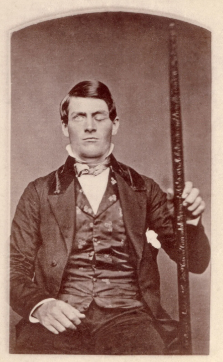 Финеас Гейдж — один из самых известных пациентов в истории медицины. В 1848 году металлический трамбовочный лом пробил его череп и мозг, но он выжил и прожил после травмы ещё много лет.