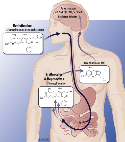Схема дефицита витамина В1 (тиамина) при длительном приеме алкоголя (источник: https://www.sciencedirect.com/science/chapter/edited-volume/abs/pii/B9780128007730000070)
