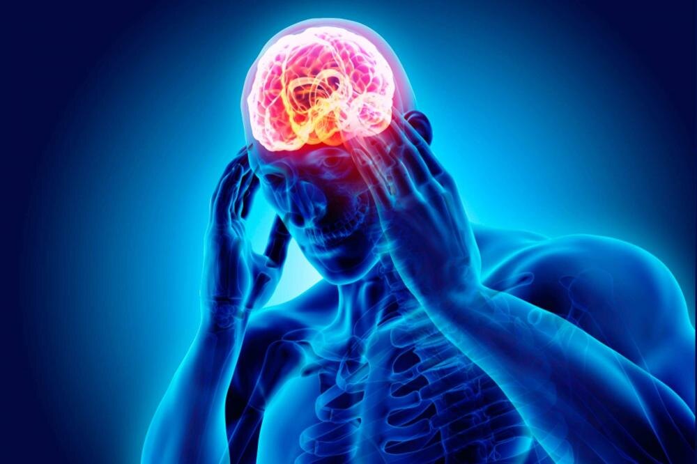 Головная боль бывает редко, но метко. Источник изображения: https://clck.ru/3SRx3E