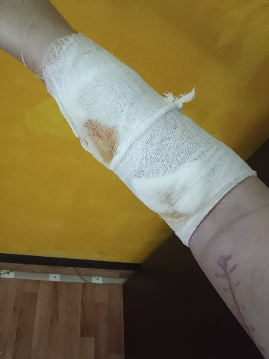 когда теряешь больше 2 литров крови "вытекаешь",правда и ложь перед тобой-по-правде..