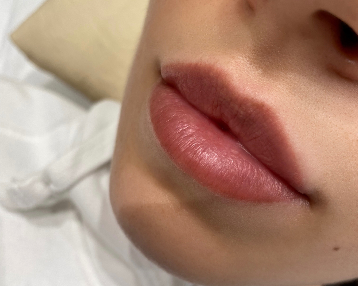Заживший ПМ губ, скрыта гиперпигментация (темные пятна) в центе верхней губы и кайма нижней губы), например другие оттенки могли бы подчеркнуть такую особенность