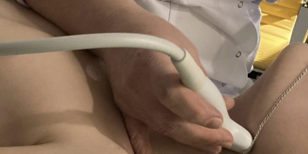 Не только процент: кардиолог — о том, почему даже большая бляшка может не требовать операции, а маленькая — убить