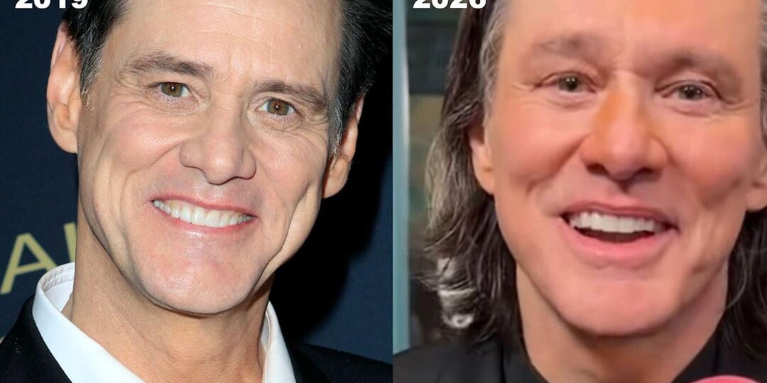 Что стало с Джимом Керри? Дорогие, это НЕ ОН! Разбор косметолога