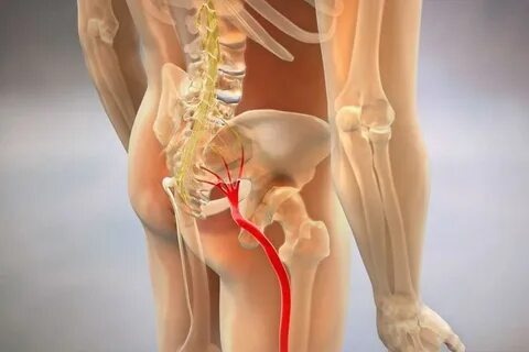 Почему боль «гуляет» по ноге и меняет характер