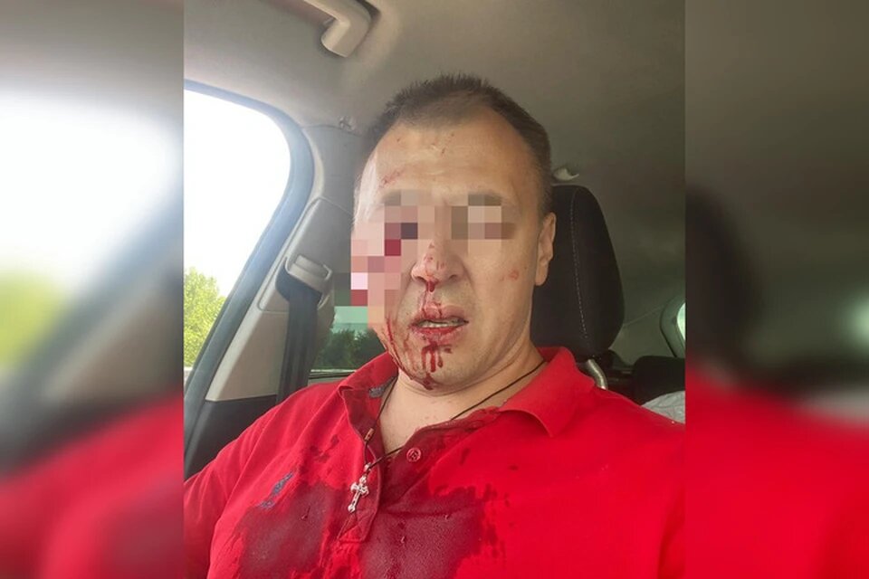 Самарец чудом выжил в чудовищном стечении обстоятельств
Фото: Предоставлено "Комсомолке".