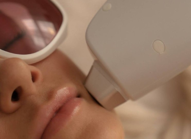 Весна в косметологии: какие процедуры можно делать, а какие лучше отложить?