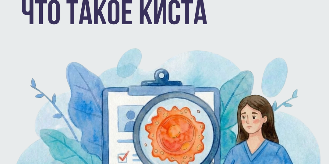 Киста — одна из самых частых находок на УЗИ у женщин репродуктивного возраста.