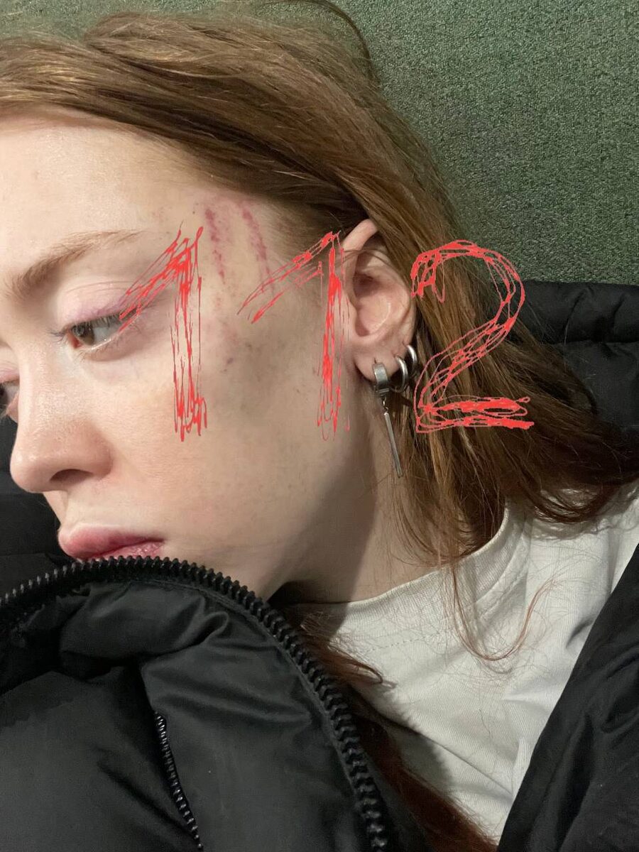    Арина заявила, что муж ее избилTelegram-канал 112