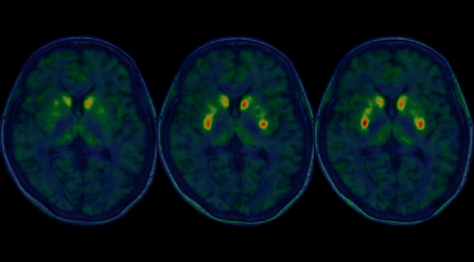   Nobukatsu Sawamoto et al. / Nature, 2025