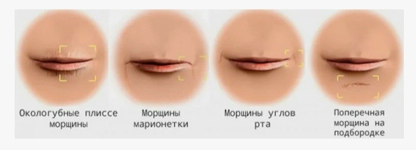 *Иллюстрация взята из интернет-источника.