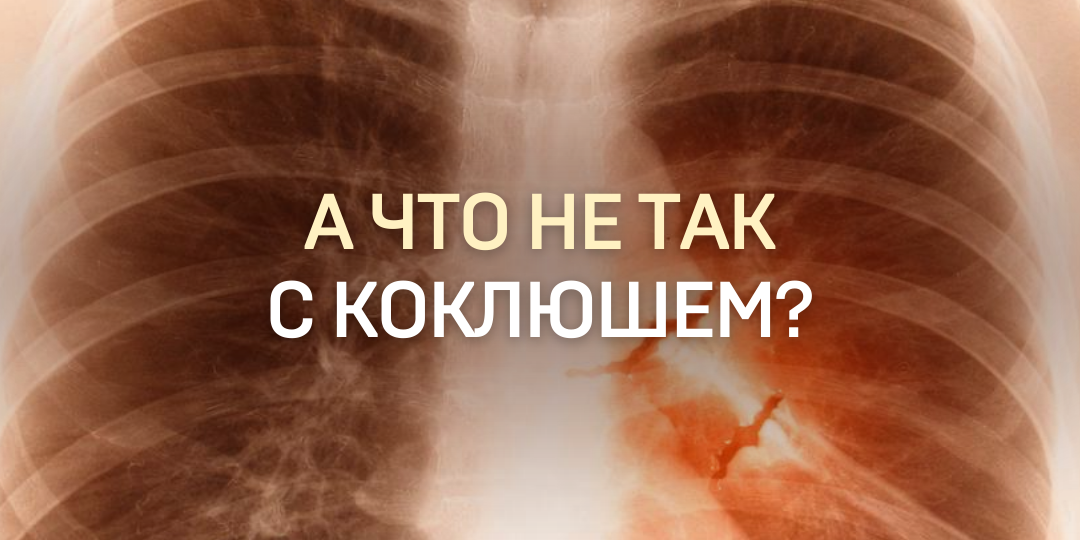 А ЧТО НЕ ТАК С КОКЛЮШЕМ?