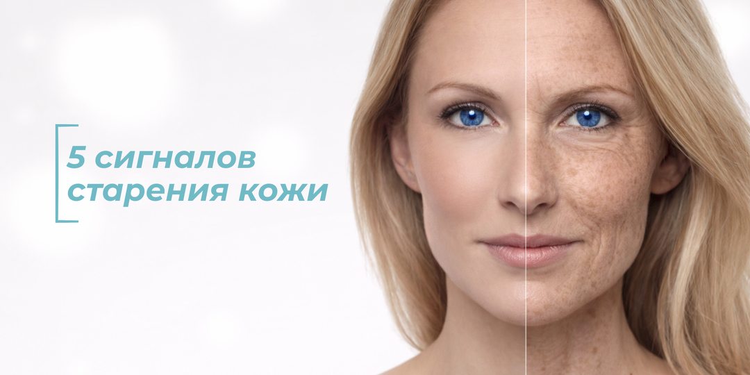 Вы думаете, что это усталость, но это возраст: 5 сигналов старения кожи