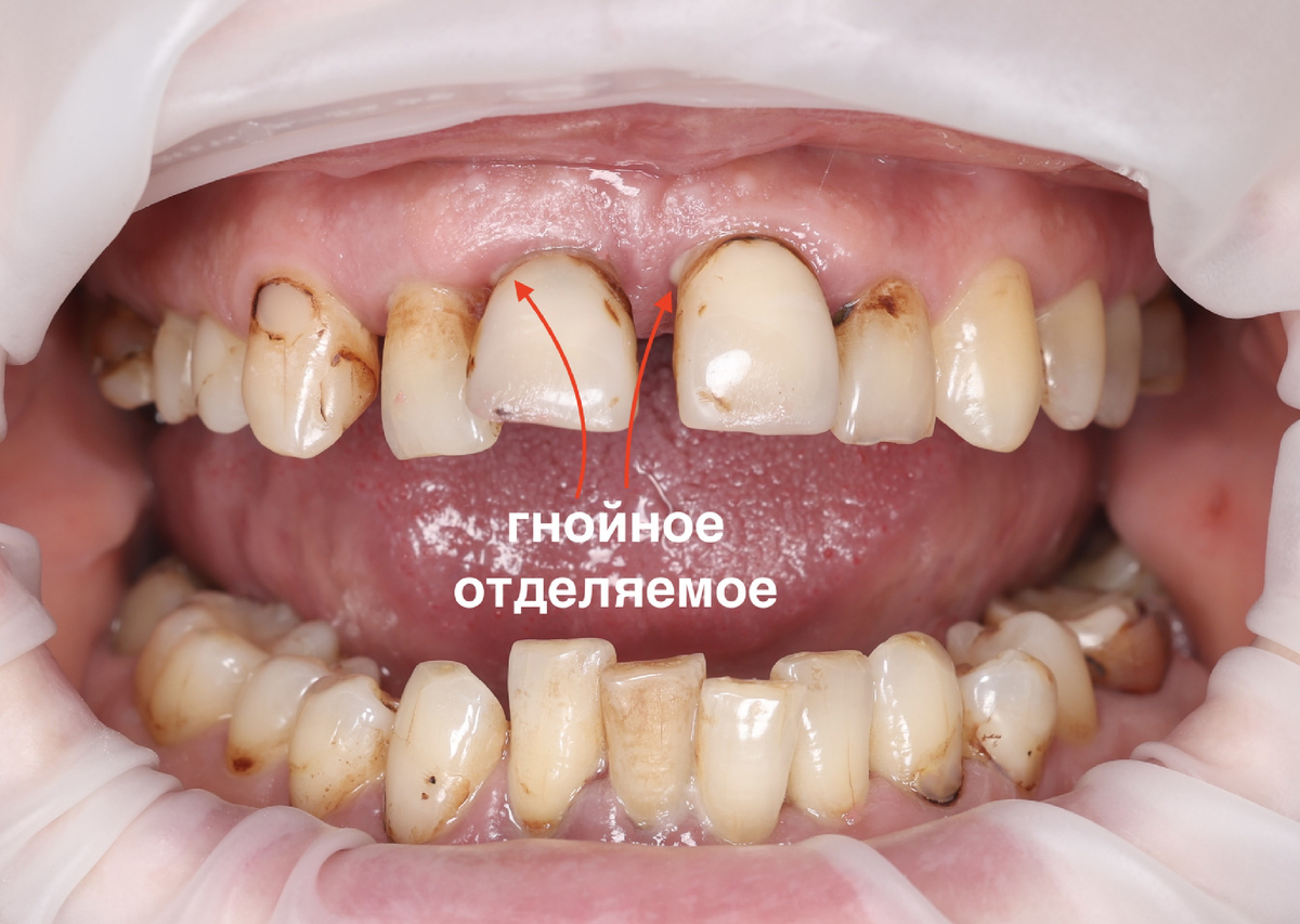 Состояние на первом приёме