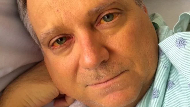 Дж. Маккэнт, перенесший трансплантацию печени после приема добавок с экстрактом зеленого чая