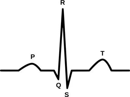 Нормальная ЭКГ