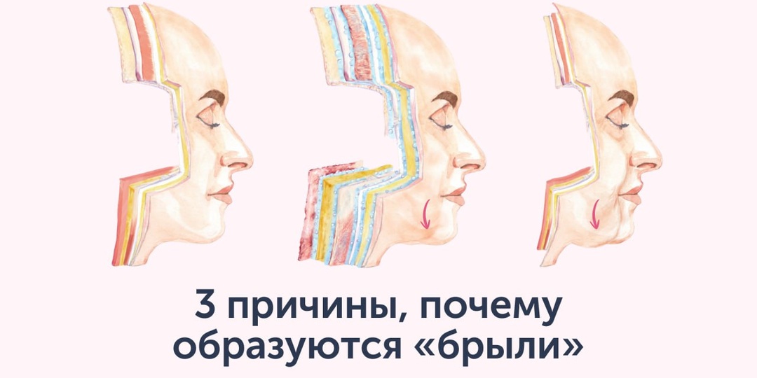 Брыли — это не лишняя кожа, которую надо отрезать